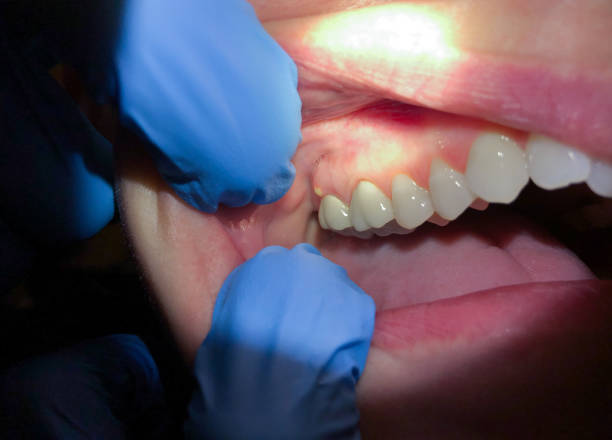 Best Weekend Emergency Dentist in Montrose, MI