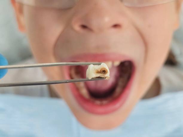 Best Same-Day Emergency Dentist in Montrose, MI